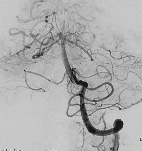 Case 2 post treatment B 